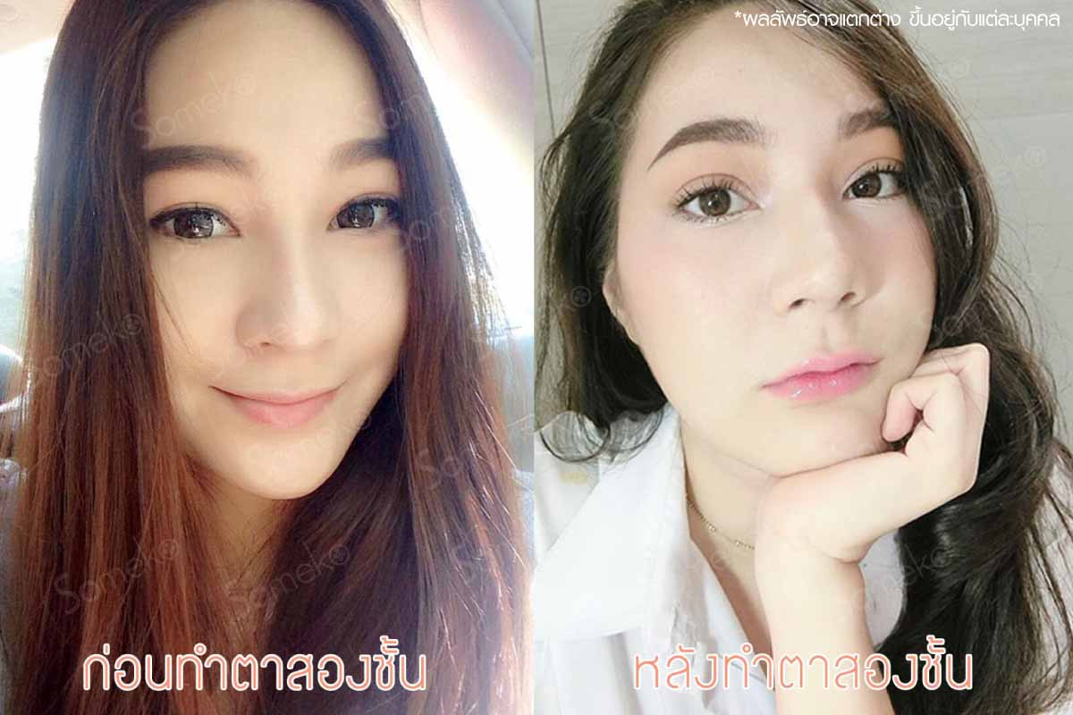 ทำตาสองชั้น สวยหวาน ทำตาสองชั้น สวยหวาน